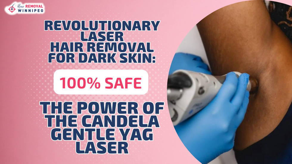 Revolutionary Laser Hair Removal for Dark Skin: 100% Safe – The Power of Candela Gentle YAG Pro