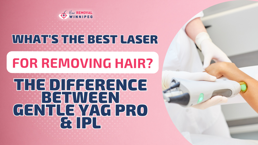 What’s the Best Laser For Removing Hair?: The Difference Between Gentle YAG Pro & IPL